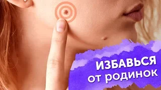 ИЗБАВЬСЯ ОТ РОДИНОК!