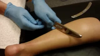 Graston Technique Treatment for Achilles Tendon Injury | Dr Jon Wilhelm Sports Chiropractor