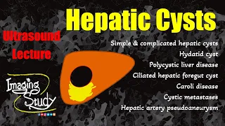 Hepatic Cysts || Cystic Lesions || Ultrasound Lecture || Imaging Study