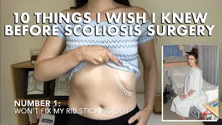 10 Things To Know Before Scoliosis Surgery | Spinal Fusion