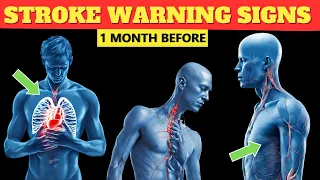 One Month Before Stroke: How to Recognize Heart Attack Symptoms Before It's Too Late!