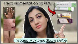 Best Cream for Hyperpigmentation (only Rs.170)|| Correct Way to Use Glyco 6 & GA-6 Cream for Melasma