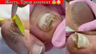 ТРЕШ контент😨 не для слабонервных 😓