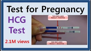 TEST FOR PREGNANCY