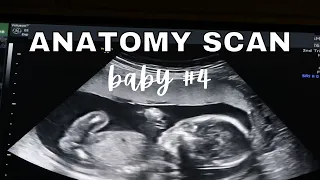 BABY 4 ANATOMY SCAN!! ANATOMY SCAN 19 WEEKS PREGNANT & BABY UPDATE