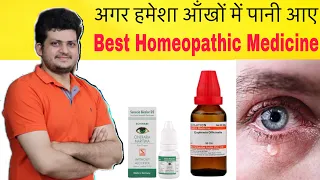 Watery eyes Best Homeopathic Medicine | आंखों से पानी आए तो दवा का उपयोग करें |