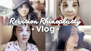 Rhinoplasty in Korea VLOG - my fight with swelling