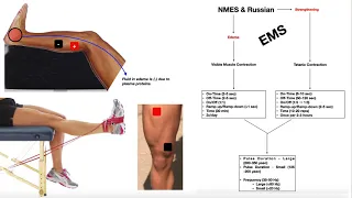 NMES & Russian Stimulation EXPLAINED | Theory, Use, & Parameters