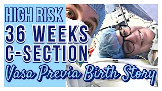 MY HIGH RISK VASA PREVIA C SECTION BIRTH STORY