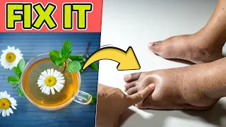DRINK IT! Top 10 Best Herbal Teas That Soothe Swollen Ankles and Feet