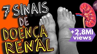 7 SINTOMAS QUE SEUS RINS PODEM NÃO ESTAR BEM (sinais de insuficiência renal)