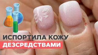 Extremely dry cuticle | Doing a clean e-file manicure