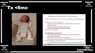 Pediatric Femur Fracture Treatment w/ Dr. Heffernan