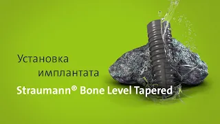 Установка имплантата: Straumann® Bone Level Tapered