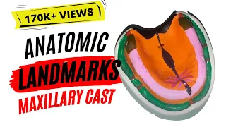 Let's Learn Anatomic landmarks in maxillary cast