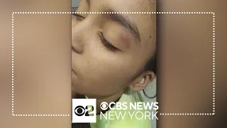 Migrant students in Queens say they're being bullied, attacked