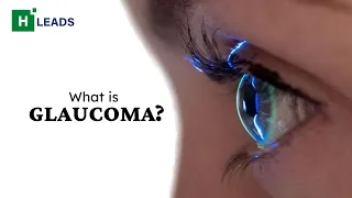 Understanding Glaucoma: Symptoms, Causes, and Treatment. #health #glaucoma