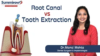Root Canal vs Tooth Extraction: What’s the Right Choice ? | Summirow Dental