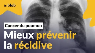 Contre certains cancers du poumon, un traitement prometteur : l’osimertinib | Interview