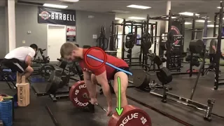 Deadlift Set Up and Tightness