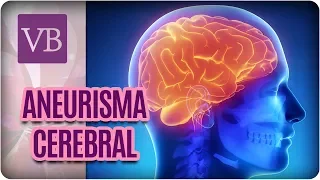 Aneurisma Cerebral: Como Identificar e Tratar - Você Bonita (01/03/185)