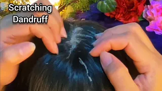 ASMR Super Tingly,Scratching  Dandruff with nails | No Talking 😴💤🥱