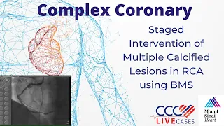 Staged Intervention of Multiple Calcified Lesions in RCA using BMS - July 19, 2011 Webcast Video