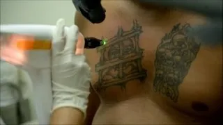 Expandilleros salvadoreños borran tatuajes por discriminación