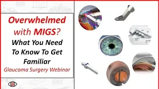 MIGS Glaucoma Surgery Webinar: What You Need to Know to Get Familiar