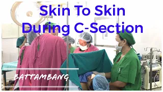 Skin to Skin During C-Section Applied in Battambang Provincial Hospital