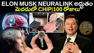 మెదడులో AI మెదడు అదుర్స్ !First Brain Chip Implant 100 Days - How Neuralink Works - AI Telugu