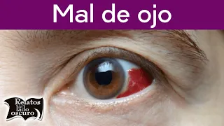 Mal de ojo | Relatos del lado oscuro