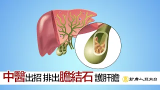 中醫出招！排出『膽結石』疏肝利膽秘笈在這裏  談古論今話中醫488