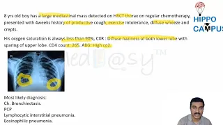 Rare Pneumonia DNB Pediatrics OSCE