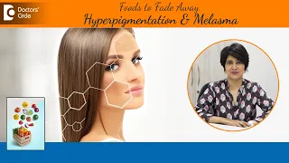 Best Diet for Hyperpigmentation & Melasma|Reduce Brown Spots on Skin-Dr.Rasya Dixit |Doctors' Circle