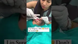 Lip Surgery real video | Lip Surgery Treatment | Dr. Anvika Mittal, MBBS, MD DERMATOLOGY | #shorts