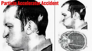 Anatoli Bugorsky Incident : The Man Who Took Radioactive Beam to the Face...and lived