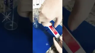 🔬Dermatofitos bajo el microscopio con tinción Lactofenol Algodón Azul.💙