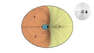 RS Vision Pathway Part3 - Prechiasmal Segment