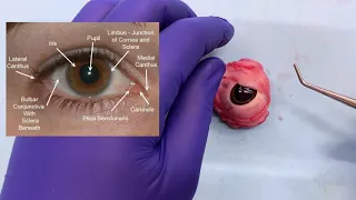 Eye Prosection