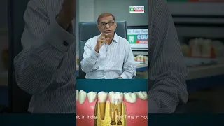 Root Canal 2nd sitting instruction ( CERAMCO DENTAL CLINIC BORIVALI )