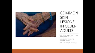 Common Skin Lesions in Older Adults