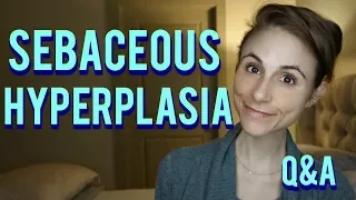 Sebaceous hyperplasia Q&A with a dermatologist| Dr Dray