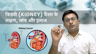 किडनी  कैन्सर - लक्षण व ट्रीटमेंट I kidney cancer symptoms and treatment