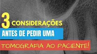 SAIBA ISSO ANTES DE DECIDIR SE VAI PEDIR UMA TOMOGRAFIA PARA SEU PACIENTE - QUICKTIP ENDOLOVERS