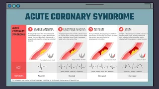 EKG in Acute Coronary Syndrome | Penyakit Jantung Koroner dan patofisiologinya