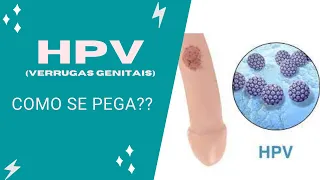 HPV:  Como pega e qual seu tratamento.