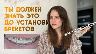 ГИГИЕНА, БОЛЬ, РЕТЕЙНЕРЫ. Не ставь брекеты, если не готов к ЭТОМУ