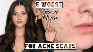 5 WORST SKINCARE MISTAKES FOR ACNE SCARS | Stop Doing This to your Skin