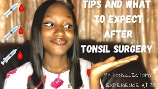 TIPS AND WHAT TO EXPECT AFTER TONSIL SURGERY | MY TONSILLECTOMY EXPERIENCE | Suu’s crib